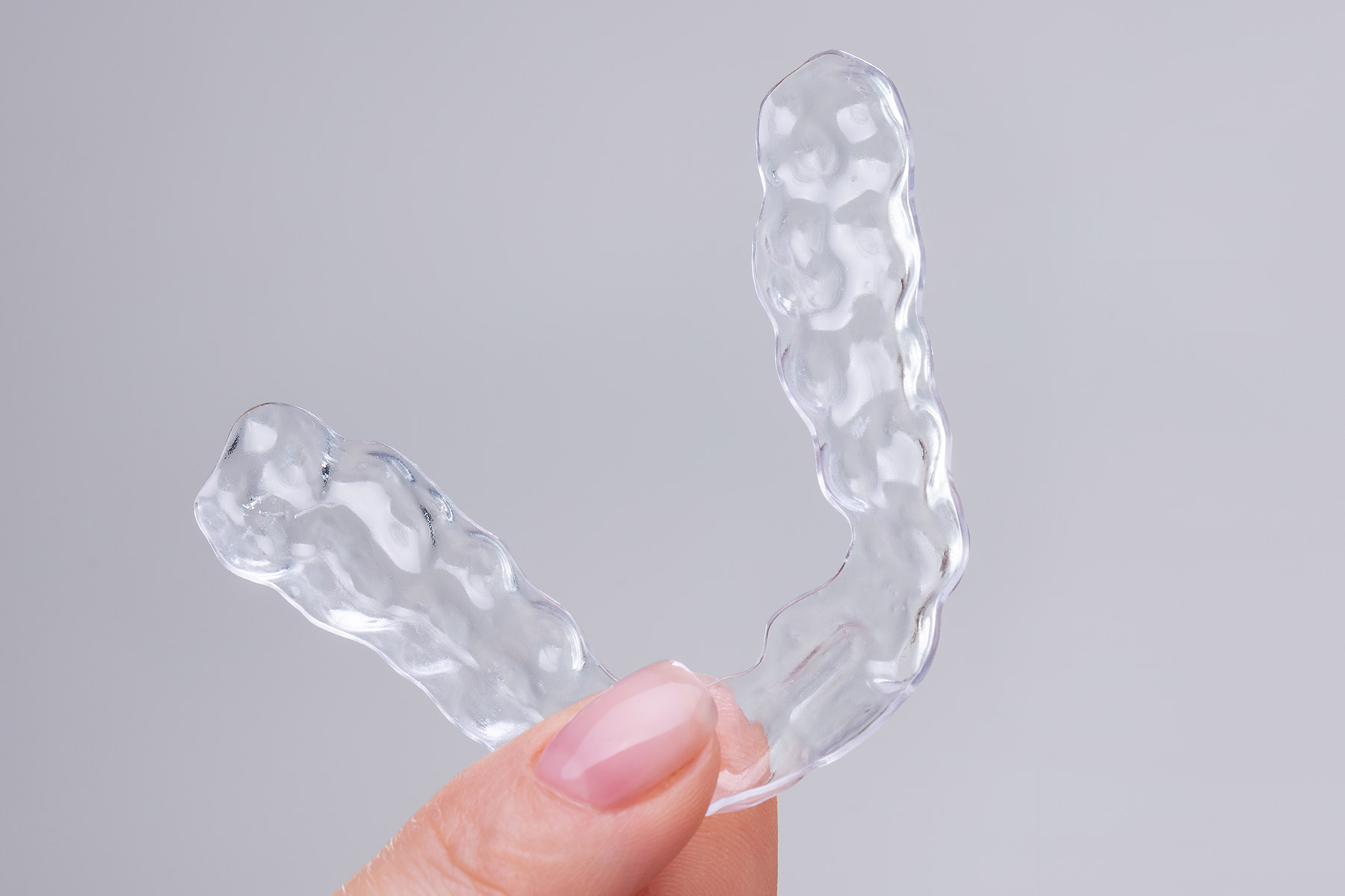 Aligner-Behandlung