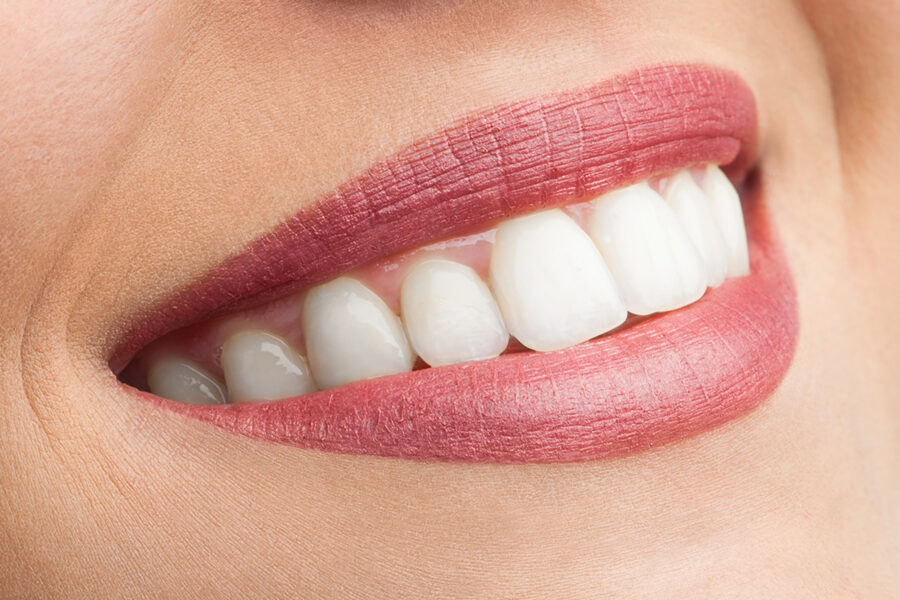 Vunder Orthodontics unsichtbare Zahnspange